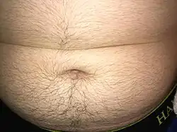 Acuminate hair growth of an adolescent teen.