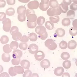Microscope slide of small Leishmania amastigotes stained purple amongst cells