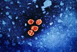 Colorized transmission electron micrograph of hepatitis B virus virions