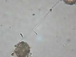 A hypha of Zoophagus insidians runs from the bottom left corner to the top left corner. Three short traps are visible along the hypha and are centered in the image. The trap closest to the bottom left corner is on the left side of the hypha; it is out of focus because it is pointing away from the camera. The next trap is on the right side of the hypha. It is also out of focus because it points toward the camera. The trap closest to the top right corner is on the right side of the hypha and is in complete focus.