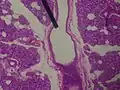 Microscopic slide of a human interlobular duct.