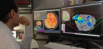 Researcher checking fMRI images.